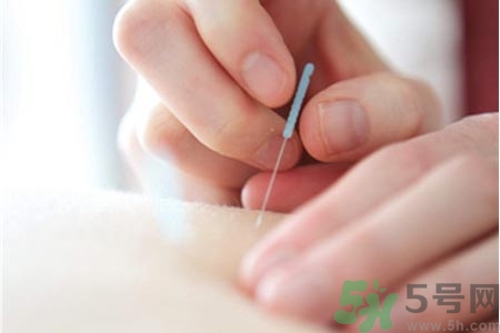 針灸一次要扎多長時(shí)間？針灸可以幾天做一次？