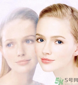 曬斑可以自己消退嗎？曬斑可以用激光去除嗎？
