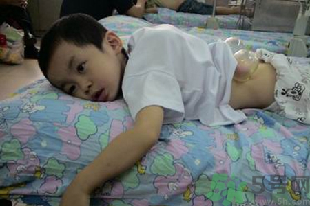 小孩可以拔罐嗎？寶寶能拔火罐嗎？