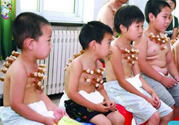小孩可以拔罐嗎？寶寶能拔火罐嗎？