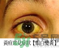 上腹部不舒服有時疼痛會不會是胰臟癌？
