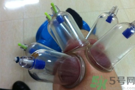 膝蓋能拔罐嗎？膝蓋疼可以拔罐嗎？