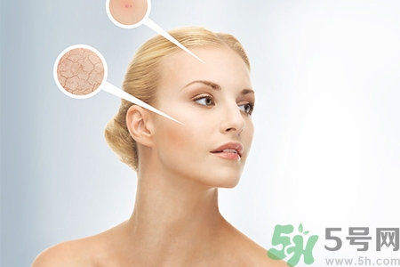 甘油會(huì)堵塞毛孔嗎？甘油堵塞毛孔怎么辦？