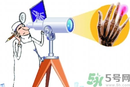 什么年齡測骨齡最好？如何測骨齡？