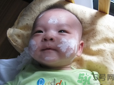 新生兒濕疹可以用爐甘石洗劑嗎？新生兒濕疹的護(hù)理措施