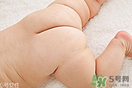 擴(kuò)肛有什么好處？擴(kuò)肛需要注意什么？