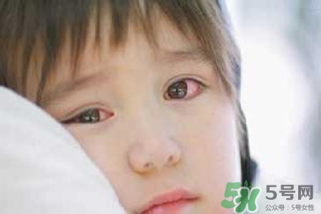 孩子為什么老眨眼睛？孩子總眨眼睛怎么回事？
