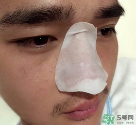 wis去黑頭套裝多少錢(qián)?wis去黑頭套裝價(jià)格