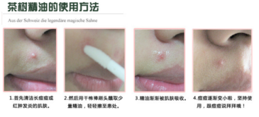 the body shop茶樹精油怎么用？美體小鋪茶樹精油怎么打開