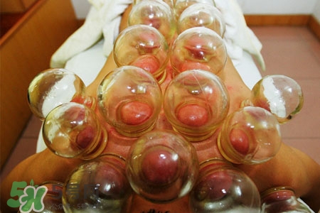 拔罐后皮膚發(fā)癢是怎么回事？拔罐后為什么皮膚會癢？