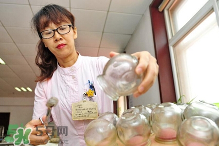 針灸火罐后多久能洗澡？針灸火罐后能馬上洗澡嗎？