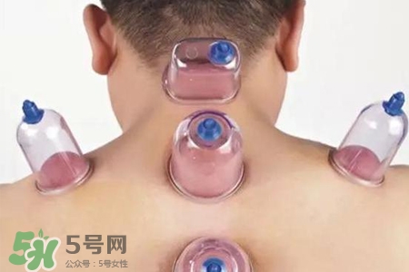 拔罐后可以喝酒嗎？拔罐后多久能喝酒？