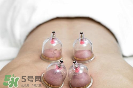 拔罐后可以泡澡嗎？拔罐后多久能泡澡？