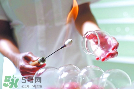 拔罐后可以泡澡嗎？拔罐后多久能泡澡？