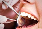 拔牙之后可以吃藥嗎？拔牙之后要不要吃藥？