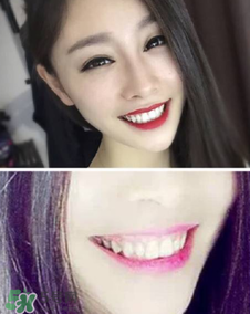 碧緹福冷光牙齒美白儀怎么用？碧緹福冷光牙齒美白儀使用方法