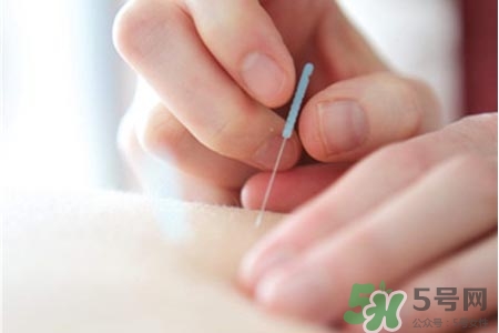 腰間盤突出可以針灸嗎？針灸能治腰間盤突出嗎？