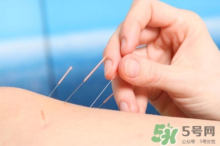 腰間盤突出可以針灸嗎？針灸能治腰間盤突出嗎？