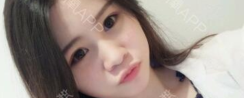 定點(diǎn)雙眼皮能保持多久？定點(diǎn)雙眼皮是永久的嗎？