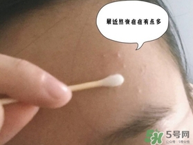 星期四農(nóng)莊茶樹精油怎么用？星期四農(nóng)莊茶樹精油使用方法