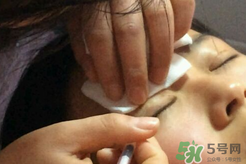 埋線雙眼皮需要拆線嗎？埋線雙眼皮怎么拆線
