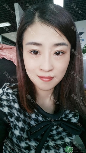 埋線雙眼皮能保持多久？埋線雙眼皮是永久嗎