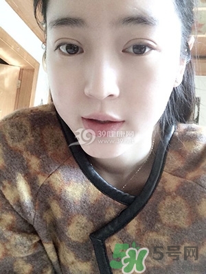 什么是定點(diǎn)雙眼皮？定點(diǎn)雙眼皮多少錢？