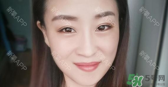埋線雙眼皮能保持多久？埋線雙眼皮是永久嗎