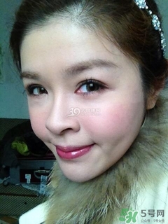 重瞼術(shù)是什么？重瞼術(shù)是永久的嗎？
