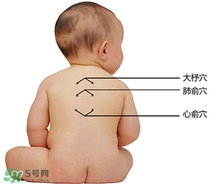三九貼能治什么病？三九貼的作用
