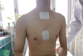 三九貼怎么貼？三九貼的貼法