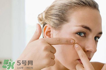 膠原蛋白能祛痘嗎？膠原蛋白可以祛痘嗎？