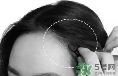 發(fā)際線高適合什么發(fā)型？發(fā)際線高怎么辦