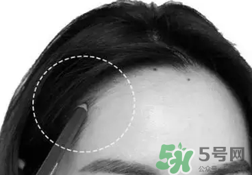 發(fā)際線高適合什么發(fā)型？發(fā)際線高怎么辦
