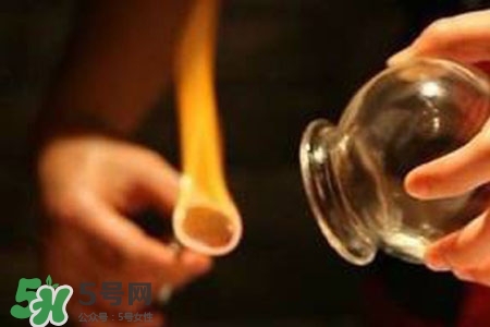 拔罐放血能治皮膚病嗎？拔罐放血能治牛皮癬嗎？