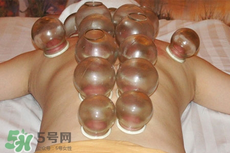 拔罐分季節(jié)嗎？不同季節(jié)的拔罐禁忌