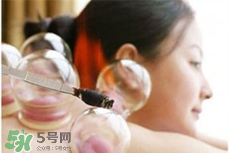 拔罐分季節(jié)嗎？不同季節(jié)的拔罐禁忌