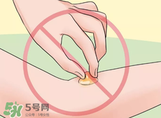 水泡怎么處理？水泡要不要刺破？