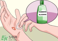 水泡怎么處理？水泡要不要刺破？