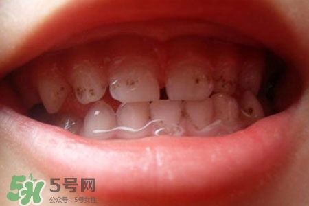 刷牙后吃東西發(fā)苦正常嗎？為什么刷牙后吃東西發(fā)苦？