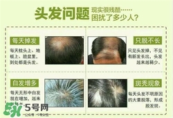牛角梳梳頭可以生發(fā)嗎？牛角梳怎么梳頭？
