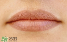 卡唇紋是什么意思？卡唇紋怎么辦？