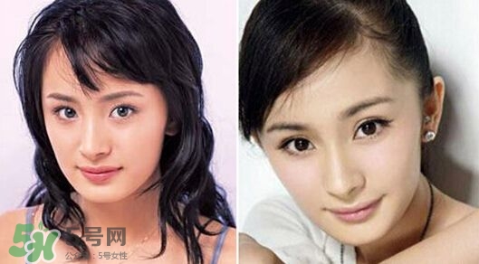 打瘦臉針能懷孕嗎？打瘦臉針能吃避孕藥嗎？