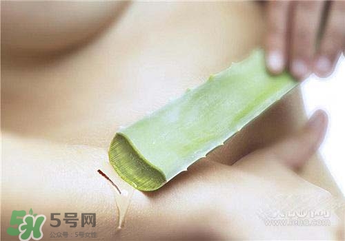 蘆薈涂在臉上發(fā)癢是怎么回事？蘆薈涂在臉上發(fā)癢怎么辦？