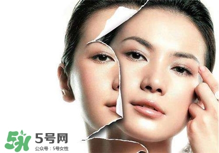 美白針是什么？美白針可以連續(xù)打嗎？