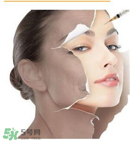 美白針安全嗎？美白針可以自己注射嗎？