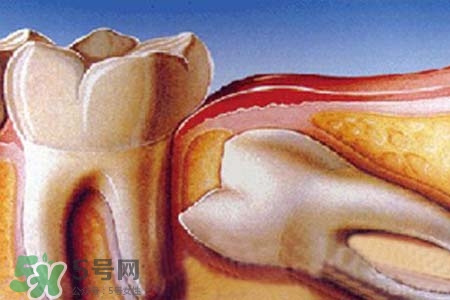 智齒會(huì)一直長(zhǎng)嗎？智齒會(huì)停止生長(zhǎng)嗎？