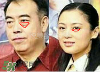 臥蠶是黑眼圈嗎？臥蠶和黑眼圈的區(qū)別