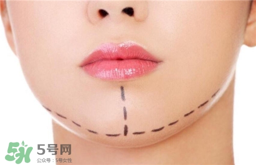 玻尿酸墊下巴能維持多久？玻尿酸墊下巴能維持多長時間？
