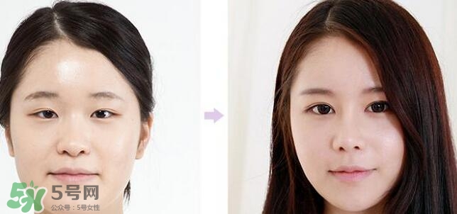 哪些人需要開眼角？需要開眼角的眼睛圖片